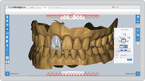 FastDesign Anterior