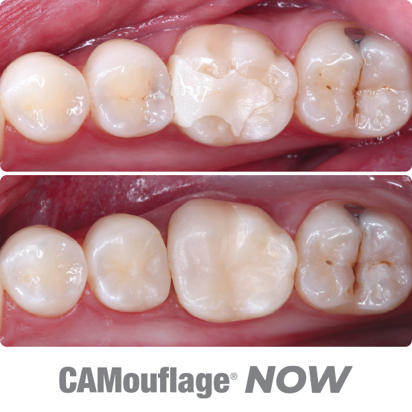 material-before-after-camouflage-now_600x600-1