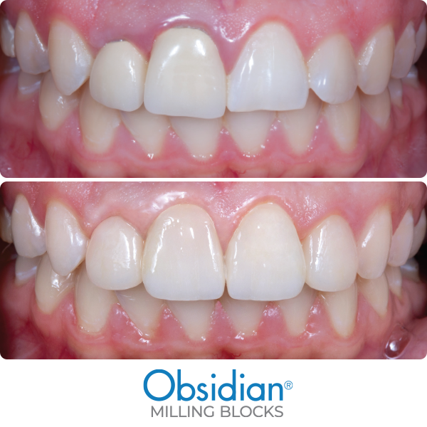 material-before-after-obsidian_600x600-1
