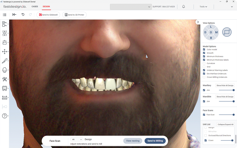 Restoration proposal